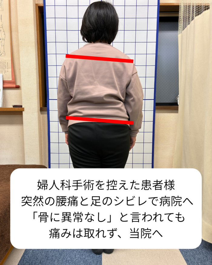手術前の不安に寄り添う。腰の痛みとしびれからの解放